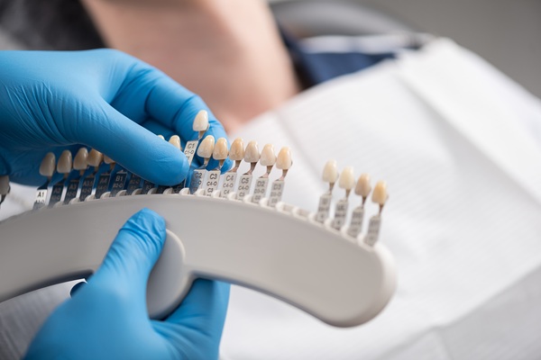 Surprising Benefits Of Dental Veneers You Did Not Know